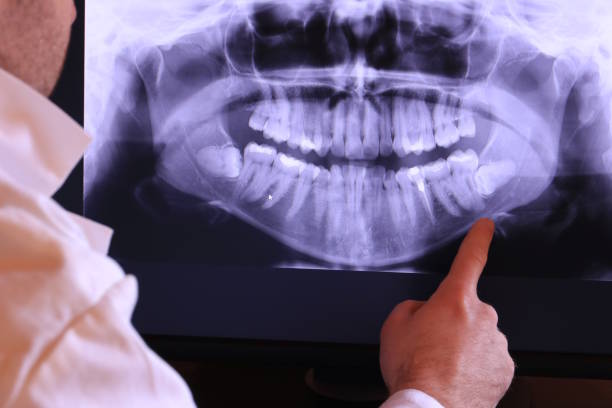 Best 24-Hour Emergency Dentist in Forest City, PA
